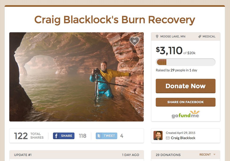 Craig Blacklock Burn Recovery